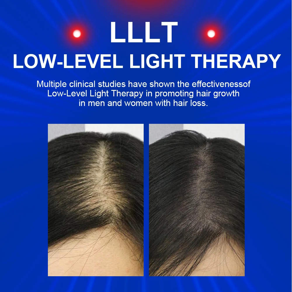 Lescolton Hair Growth Helmet LLLT Red Ligtht Cap Hair Loss Treatments For Men & Women Anti Hair Loss Hair Restore Products