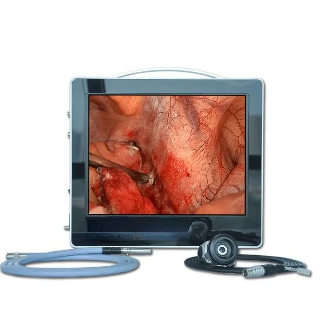 

All-in-one ENT Endoscopy Portable Full HD Price YKD-9115E