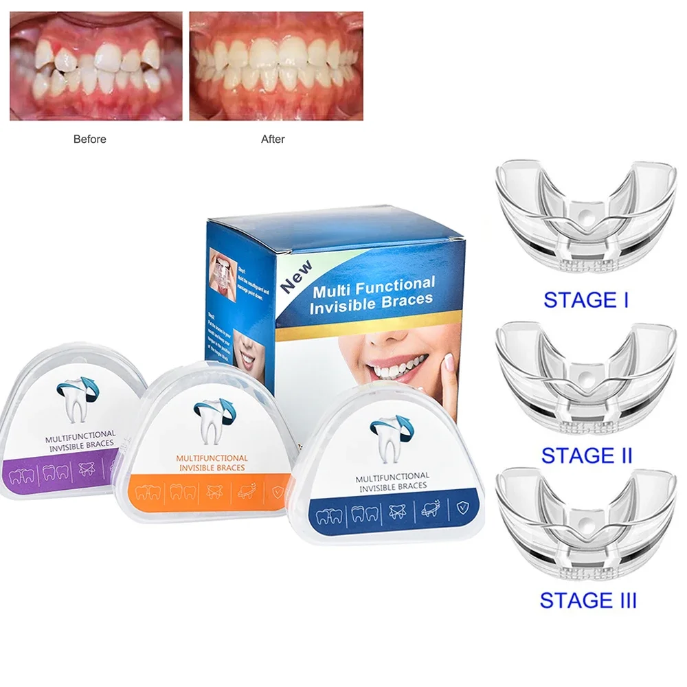 

Dental Orthodontic Braces 3 Stages Teeth Straightener Instanted Silicone Teeth Retainer Alignment Tooth Tray Mouth Guard Braces