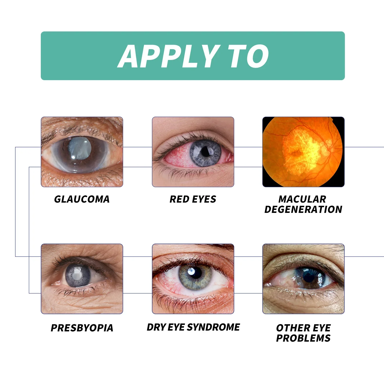 Korean Visual Enhancement Eye Serum Roller Relieve Eye Aningeresting Dark Circles Bags Eye Contour Moisturizing Cosmetics 8ML