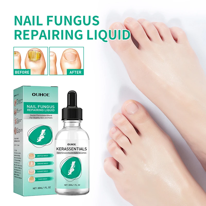 Fungal Nail Treatment Essence Oil Nail Fungus Laser Device Repair Toenail Fingernail Treatment Onychomycosis with Mushrooms 30ml