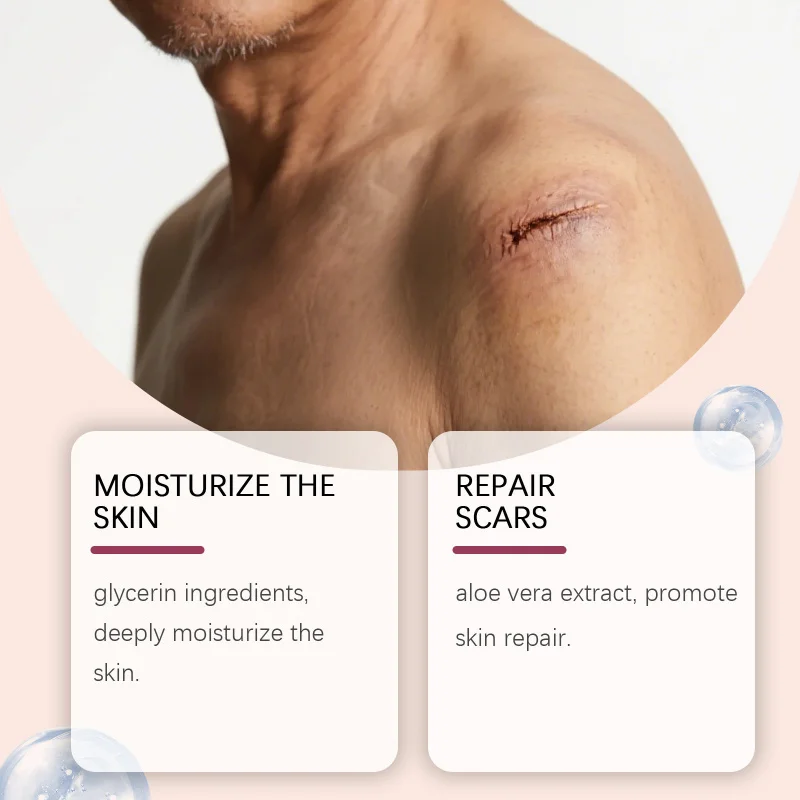 مصل العناية بالترطيب والتقشير يزيل الخلايا الميتة ويغذي ويحسن التصاق مكياج الكعب