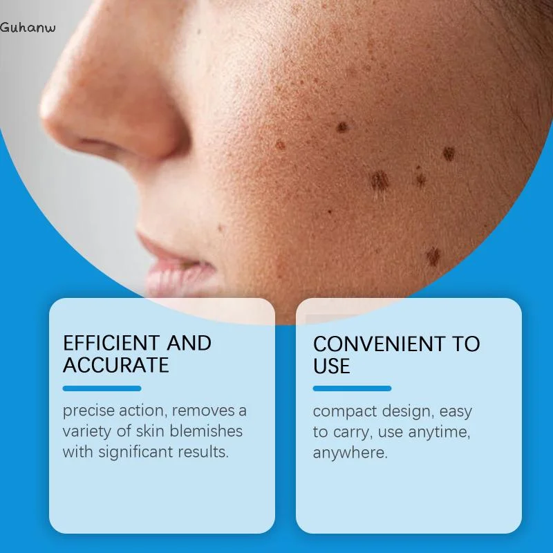 

[WHB]Skin Care Pen Wart Eliminator Face Freckle Black Dots Blemish Removal Mole Nevus Remover Pen Skin Cleansing Tools