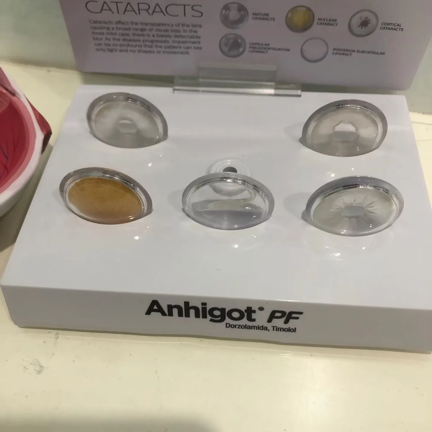 

Модель глаза Модель ока катаракта, обучающая экспериментальная медицина Анатомическая модель Выставка клиники глаз