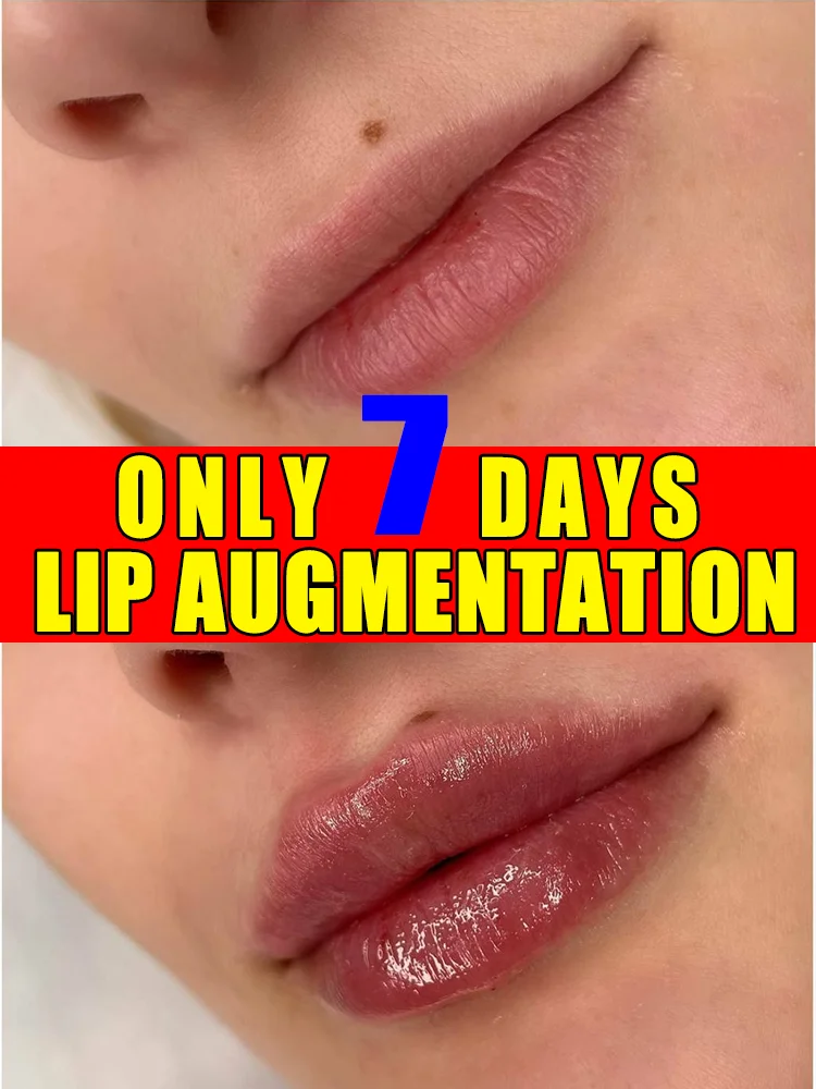 

Rellena и Hidrata para unos labios Zortivos.