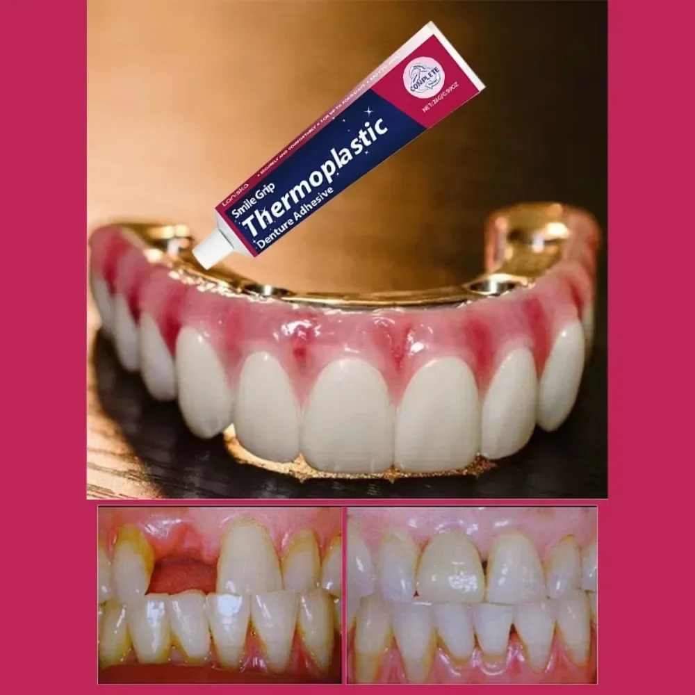 الراحة أسنان المواد اللاصقة الغراء العناية بالأسنان طقم أسنان من السيليكون ريلين كيت لاصق وسادة الاحتكاك أطقم الأسنان الثابتة