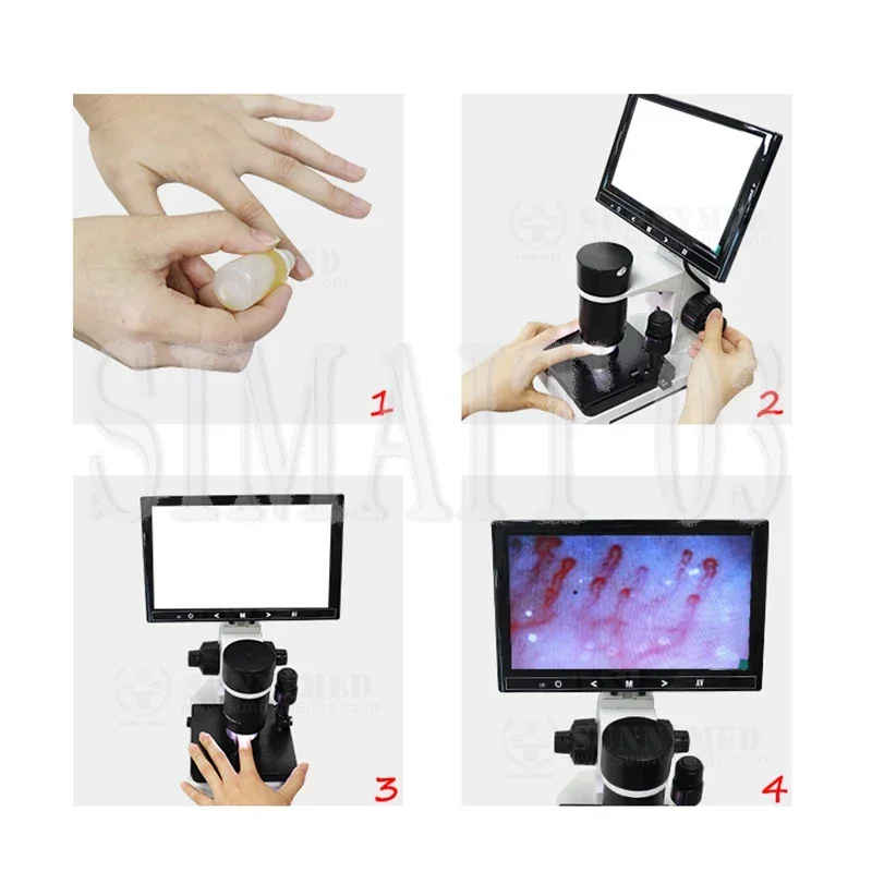 

SY-B198 Капиллоскопический микроскоп — с 9-дюймовым ЖК-дисплеем для капиллярной визуализации складывания ногтей