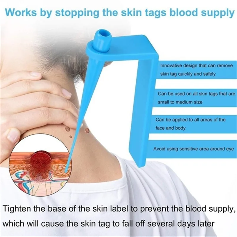 Skin Tag Removal Kit Papillomas Treatment Skin Cleansing Tools Micro Band 4-6mm For Berrugas Warts Remove Mole Wart Face Care