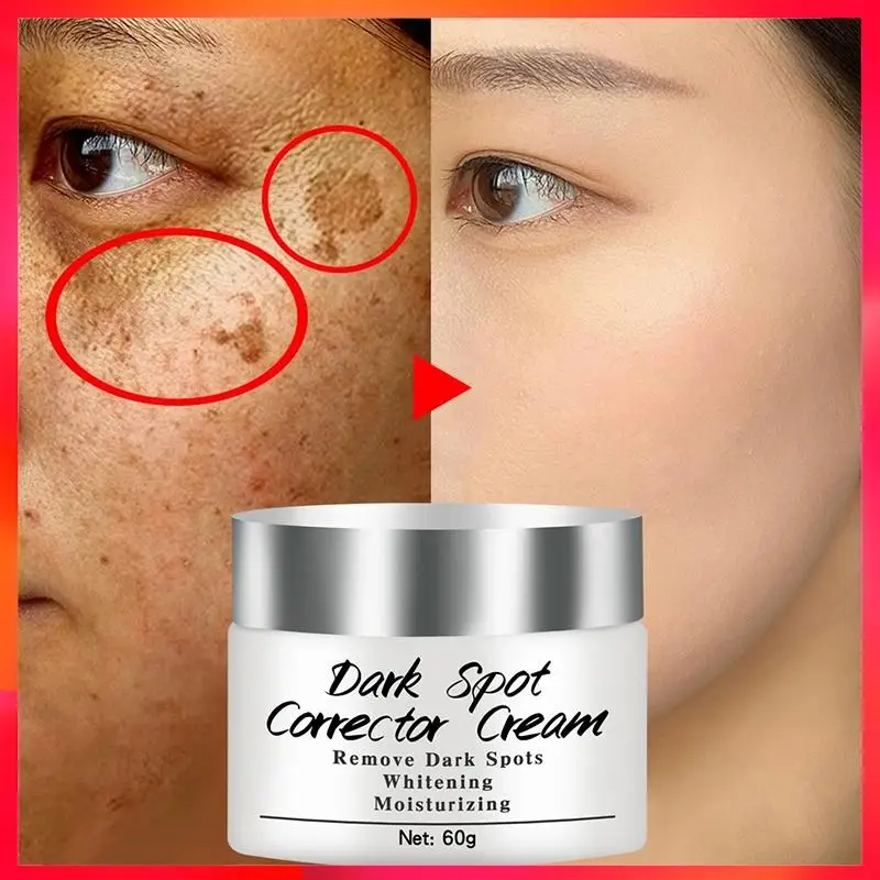 

Newest Dark Spots Corrector Cream Whitening Facial Cream Repair Fade Freckles Remove Dark Spots Melanin