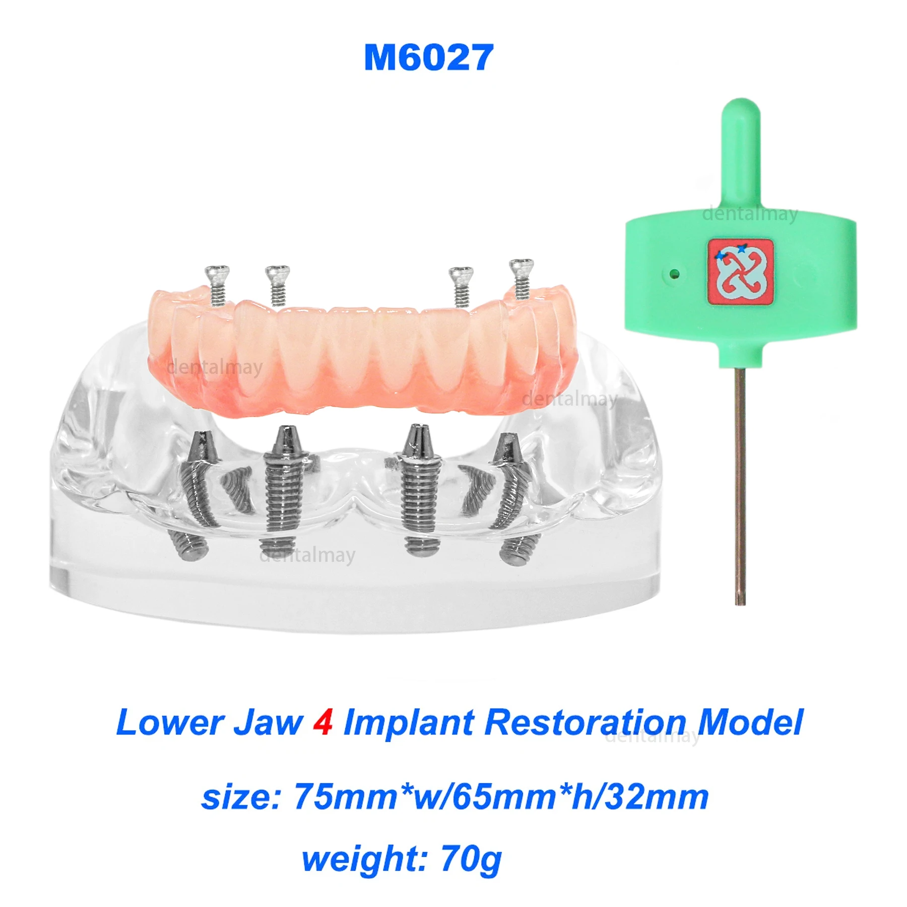 New Style Dental Implant Overdenture Restoration Model Lower Jaw with Post Core Bridge 4 Screws M6027