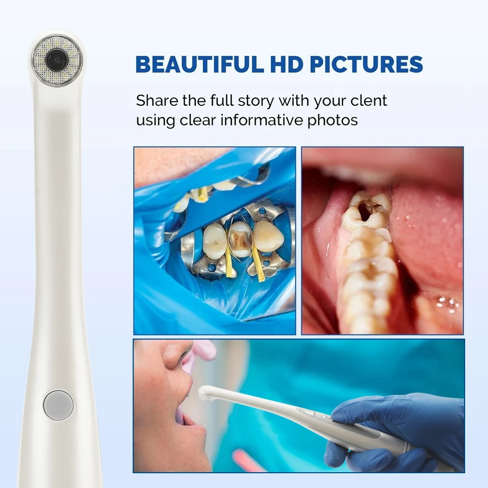 Dental Intraoral Camera MD-1030 1080P HD USB 12 LED Dental Endoscope for Dental Examination