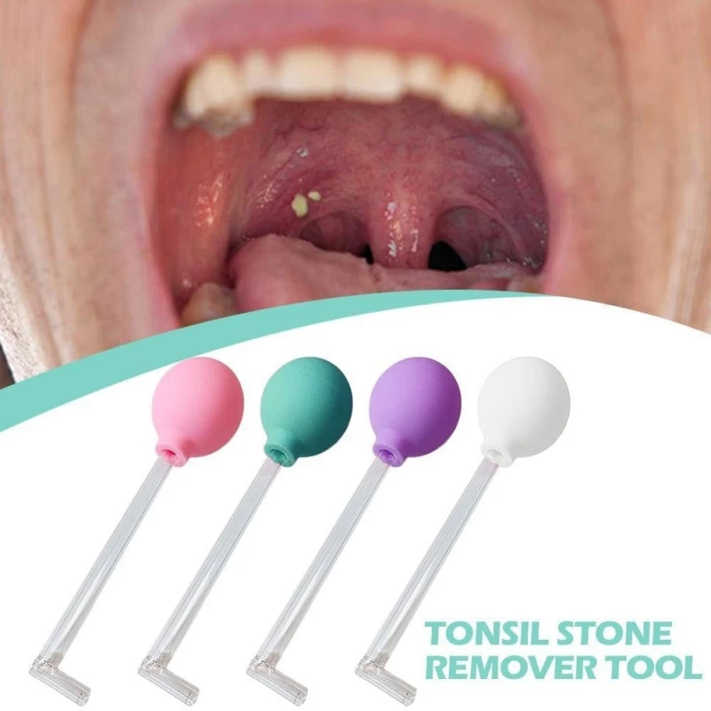 Tonsil Stone Remover Manual Style Oral Cleaner Tonsil Stone Removal Vacuum Kit Mouth Cleaning Suction Cupping Tools for Adults