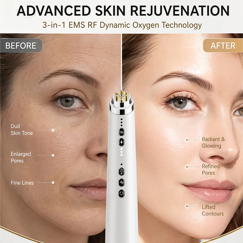 stylo-a-oxygene-dynamique-ems-rf-professionnel-3-en-1-rechargeable-outil-facial-anti-rides-pour-le-lifting-le-raffermissement-et-la-revitalisation-de-la-peau