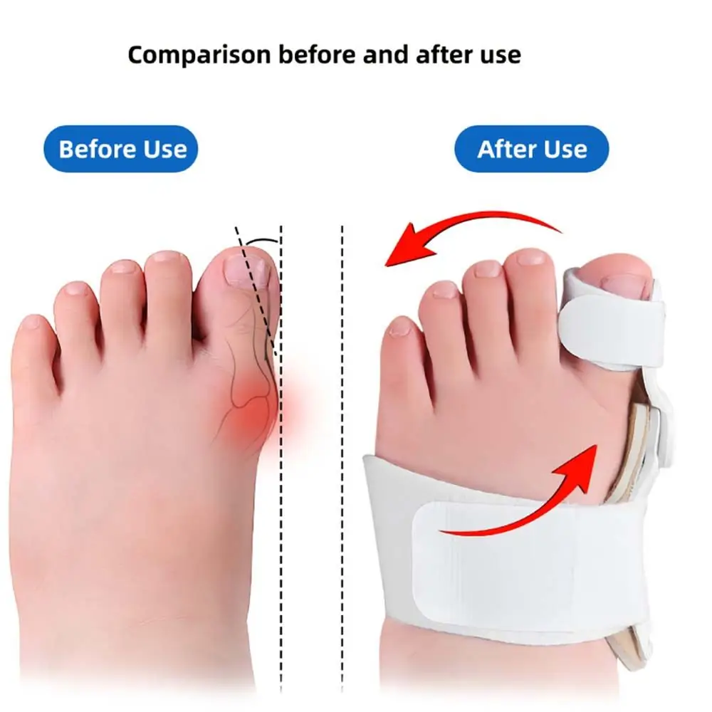 Orthopedic Supplies Toes Protector Toe Valgus Corrector Big Toe Straightener Bunion Splint Brace Children Toe Separators