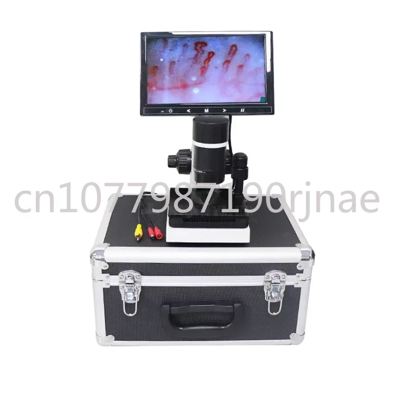 

SY-B198 Capillary Microscope With 9 Inch LCD Screen Nail Fold Capillaroscope