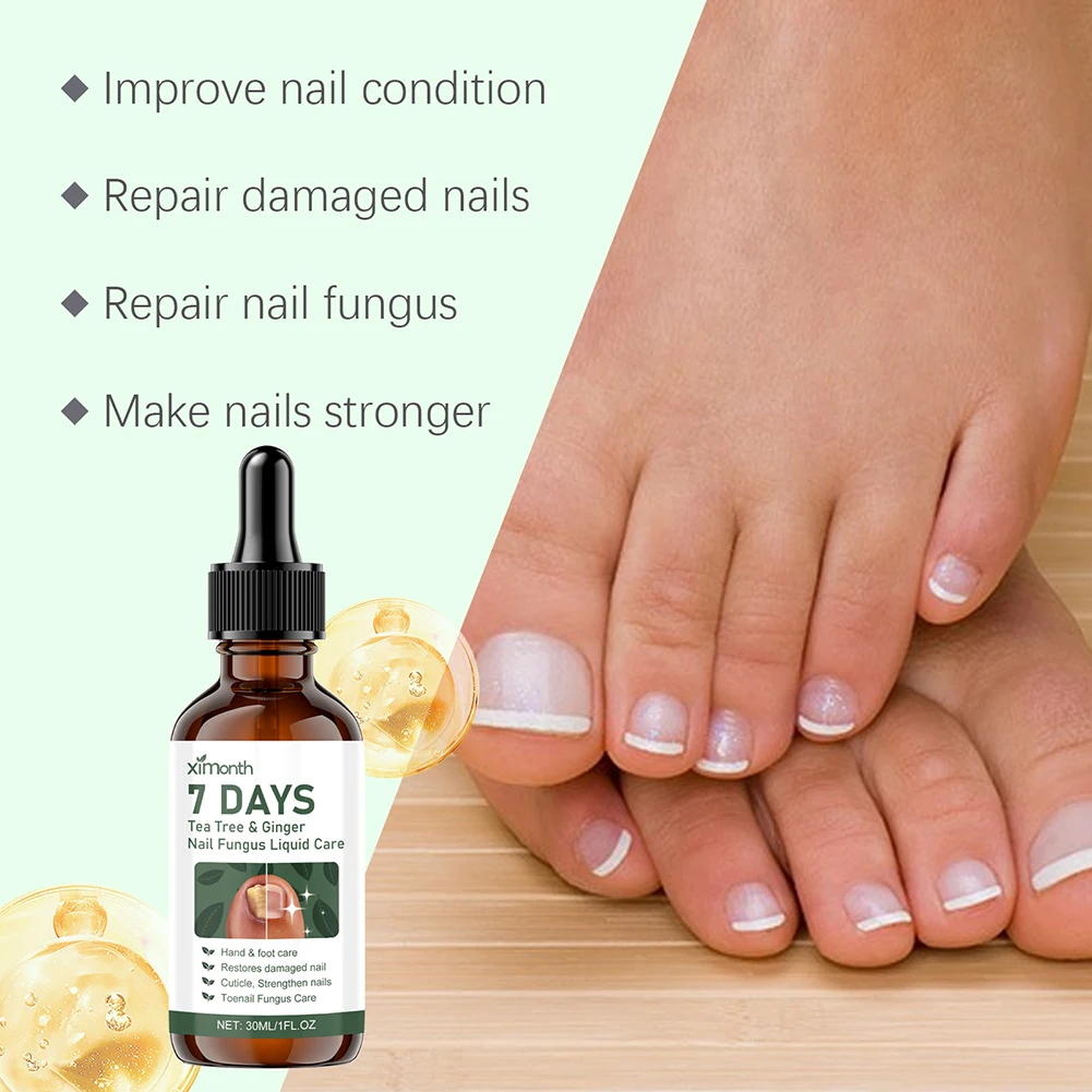 

Natural-Solution For Health Nai Easy To Absorb Anti Nail-Fungus Liquid For All Nail Types