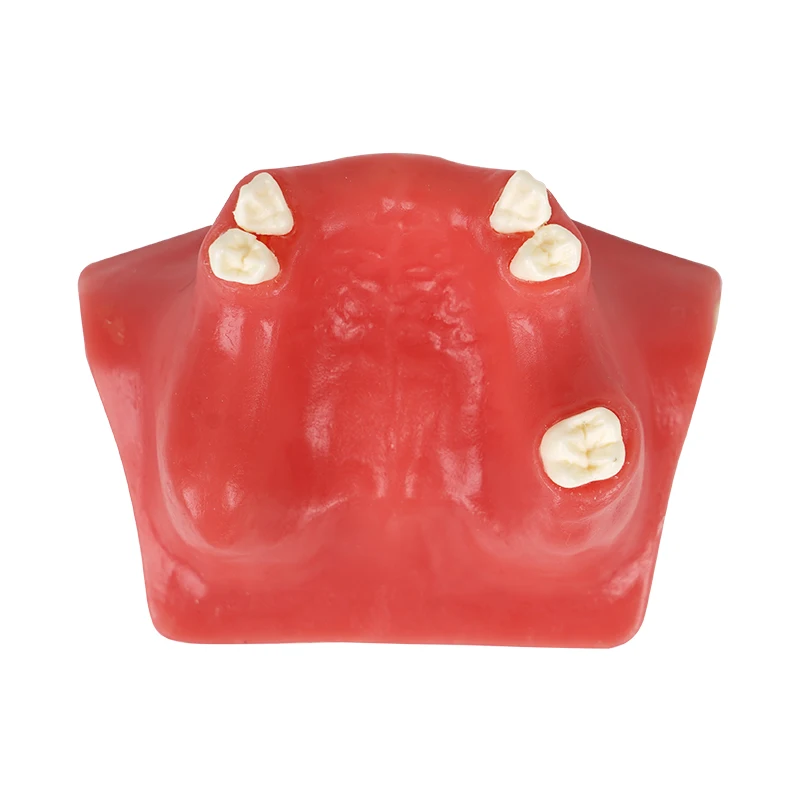 Dental Model Teeth Implant Maxillary Mandibular Sinus Practice Teeth Model Implants Dentist Practice Studying Tools
