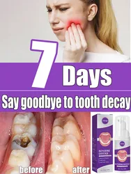 Anti-Tooth Decay