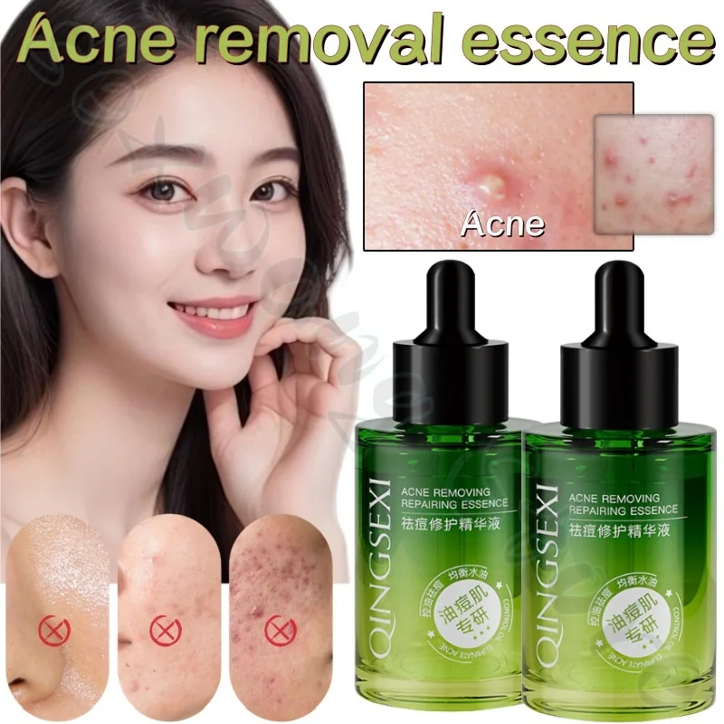 

30ml small green bottle repair essence soothing and moisturizing facial balance oil clears pores gentle and not irritating