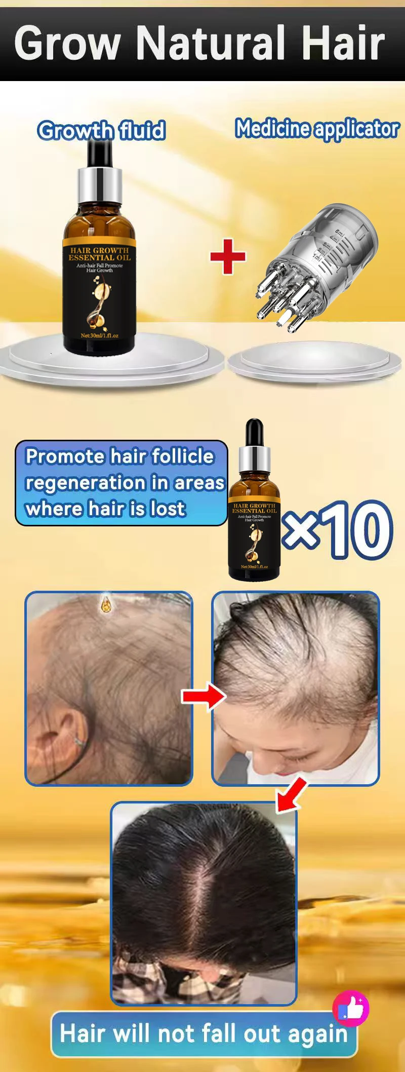 育毛エッセンシャル 脱毛症対策 発毛促進トリートメント 髪を強化 頭皮に栄養を与える 軽量でべたつかない 頭皮の血行を改善