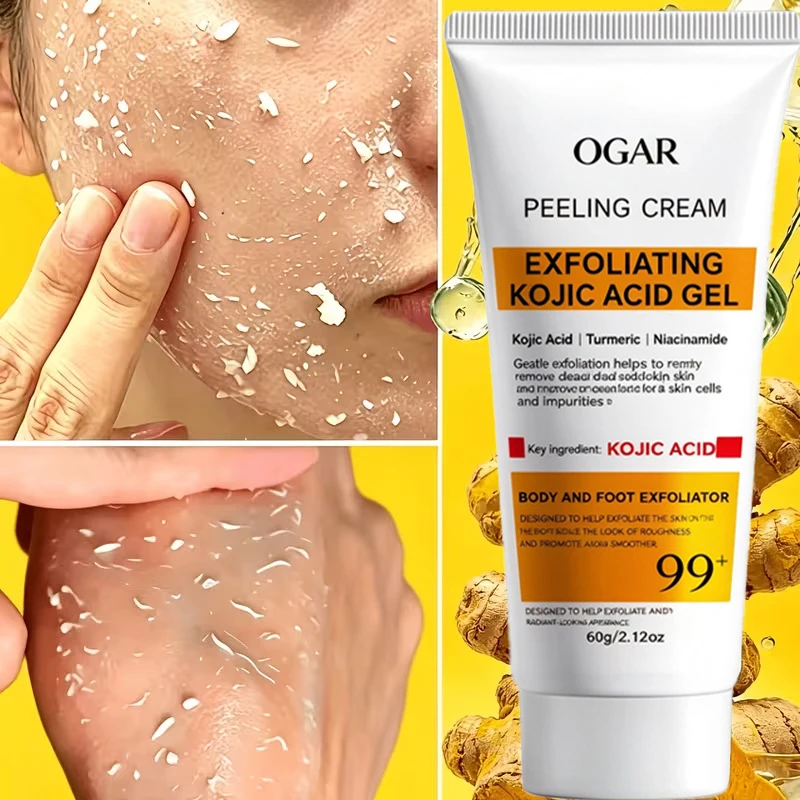Kojic Acid Peeling Cream Exfoliating Gel Gentle Dead Skin Remover For Face Body Foot With Turmeric And Niacinamide Skincare