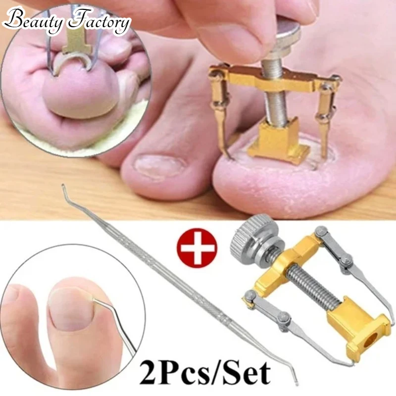 ingrown toenails correction pedicure foot toe nail care tools file Elastic Patch Straightening Clip Brace corrector Wire Fixer