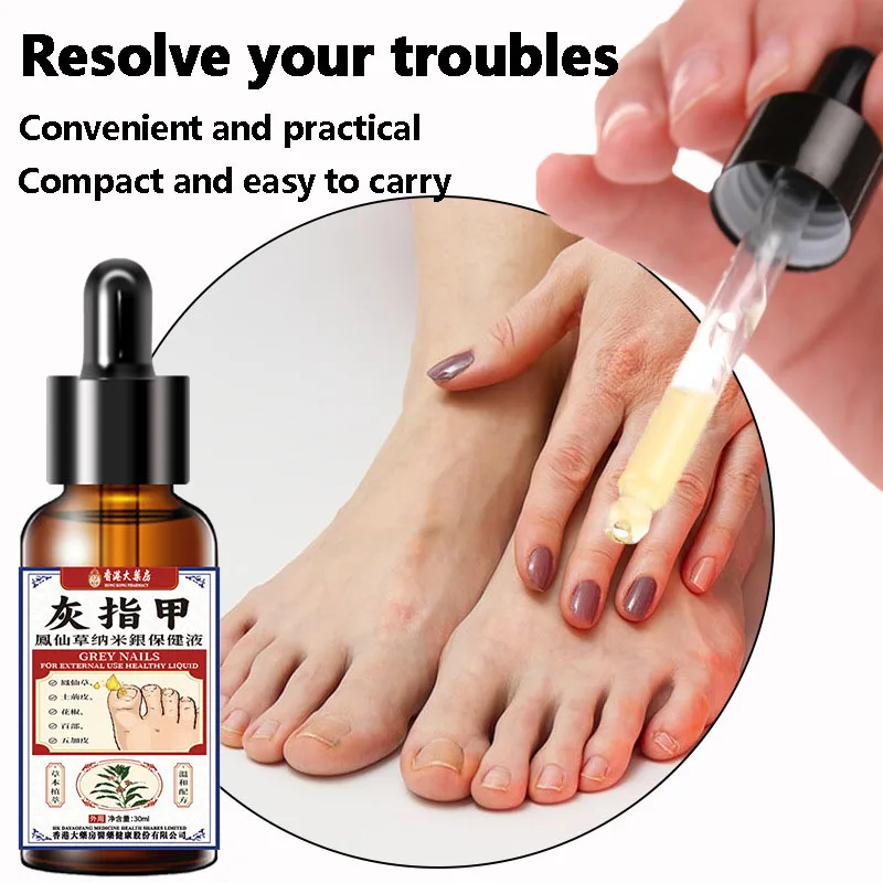 Nail Fungus Treatment Serum Foot Repair Liquid Toe Nails Fungal Removal Gel Anti Infection Paronychia Onychomycosis Cream 30ml