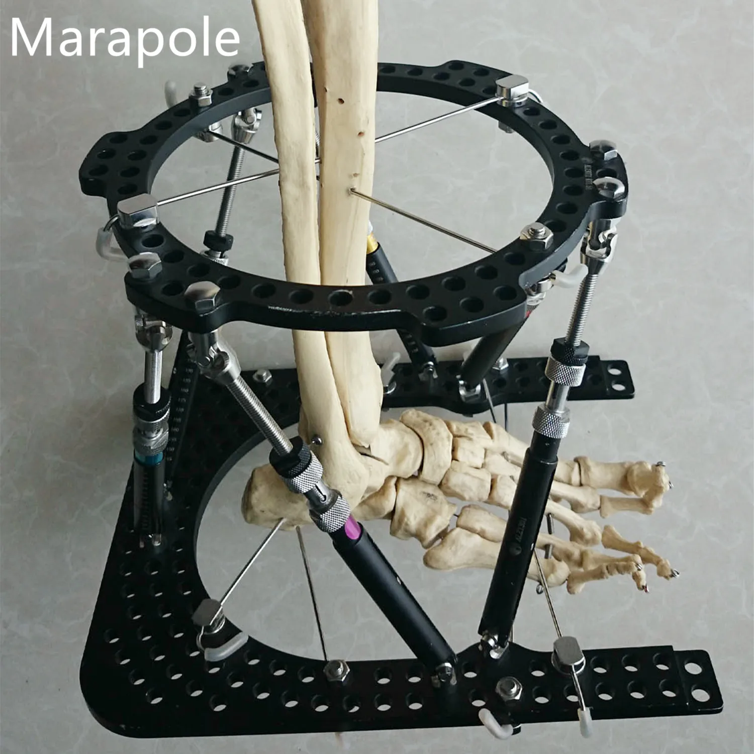 Orthopedic Instrumentst external fixator,Bone Lengthening External