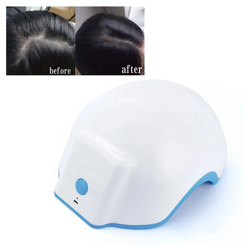 

Hair Growth Helmet Anti Hair Loss Treatment Have Hair Growth Cap Hair Loss Therapy Device Hair Therapy Massage Machine Home