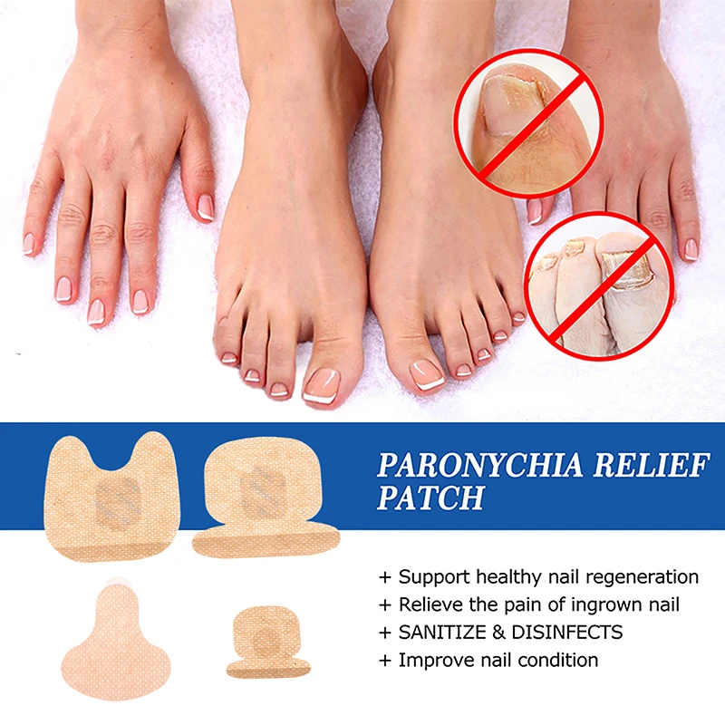 แพทช์ซ่อมเล็บสีเทาเชื้อราเล็บหนานุ่ม Paronychia Treatment Anti Infection Correction สติกเกอร์คุด Toenail Care