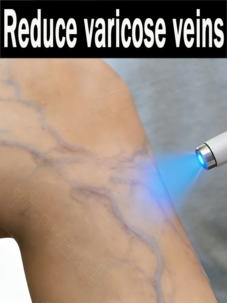 

Lᴇɢ ᴄᴀʀᴇ ᴘʀᴏᴅᴜᴄᴛs ᴛʜᴀᴛ ᴄᴀɴ ᴛʀᴇᴀᴛ ᴏʀ ʀᴇᴅᴜᴄᴇ ᴠᴀʀɪᴄᴏsᴇ ᴠᴇɪɴs