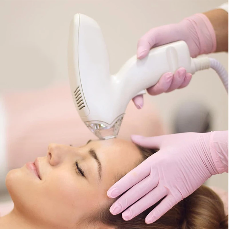 الحرارية كسور جهاز إزالة الندبات RF تجديد الجلد شد الوجه جهاز إزالة التجاعيد تمتد علامات أداة إزالة الصواميل