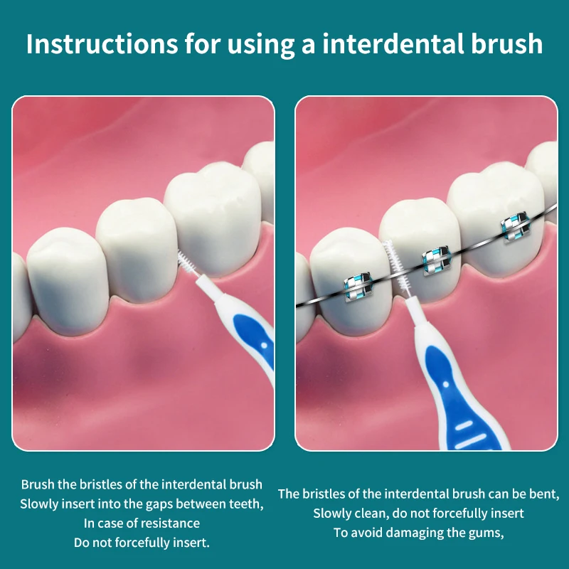 10 Stks/doos Interdentale Borstels Voor Orale Reiniging Wegwerp Tandenstoker Borstel Draagbare Interdentale Borstel Mondhygiëne Zorg