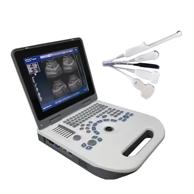 Medical Ultrasound Instruments Manufacturer Ultrasonido Medico B/W Portable Ultrasound Machine Price