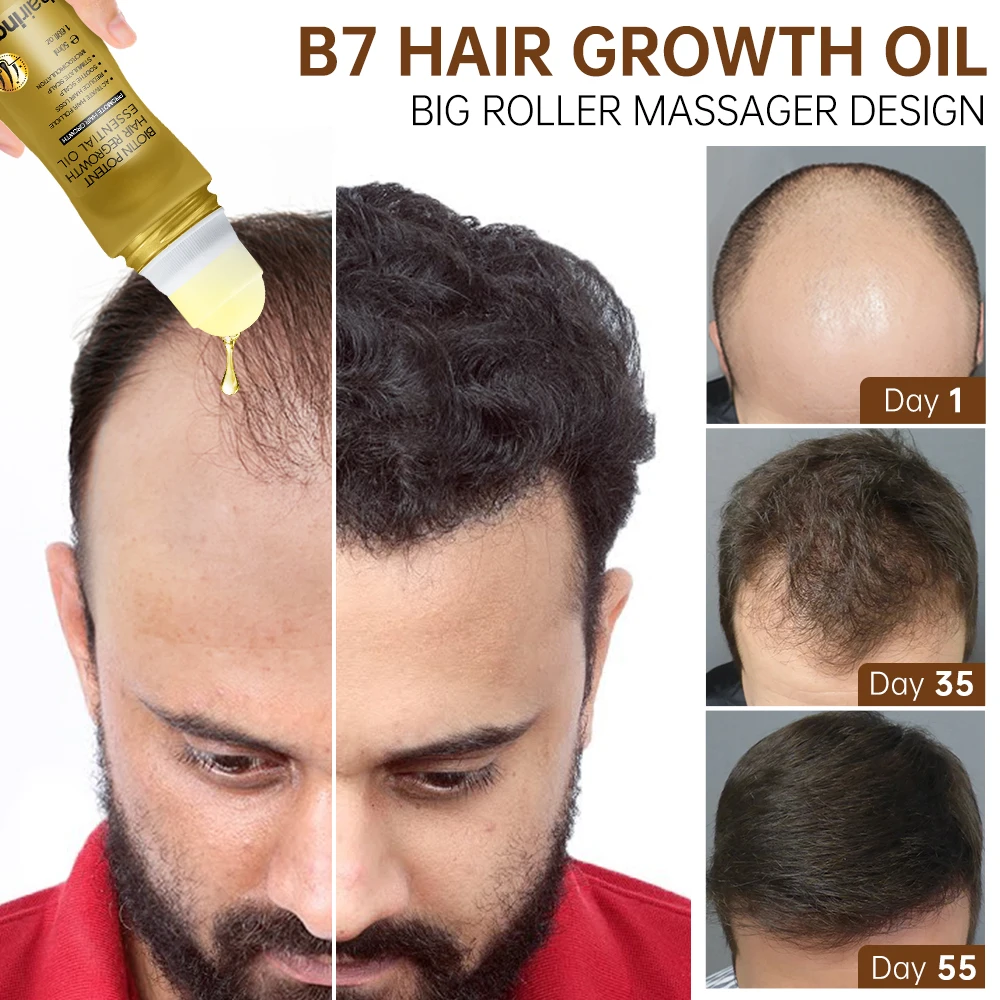 

Hair Growth Oil for Men Women Anti Hair Loss Regrowth Thicken Solution Roller Scalp Treatment Hair Grow Care Products