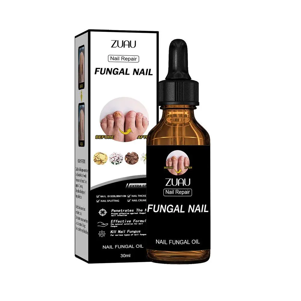 Nail Fungus Treatment Essence Anti Infection Paronychia Care Onychomycosis Hand 30ml Removal Foot Repair Fungal Nourishing J3J0