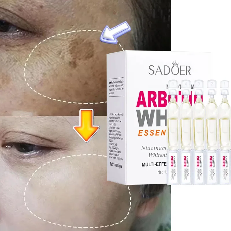 

Niacinamide Whitening Freckles Serum Dark Spots Melasma Remover Lighten Melanin Pigmentation Brightening Anti-Aging Beauty Care