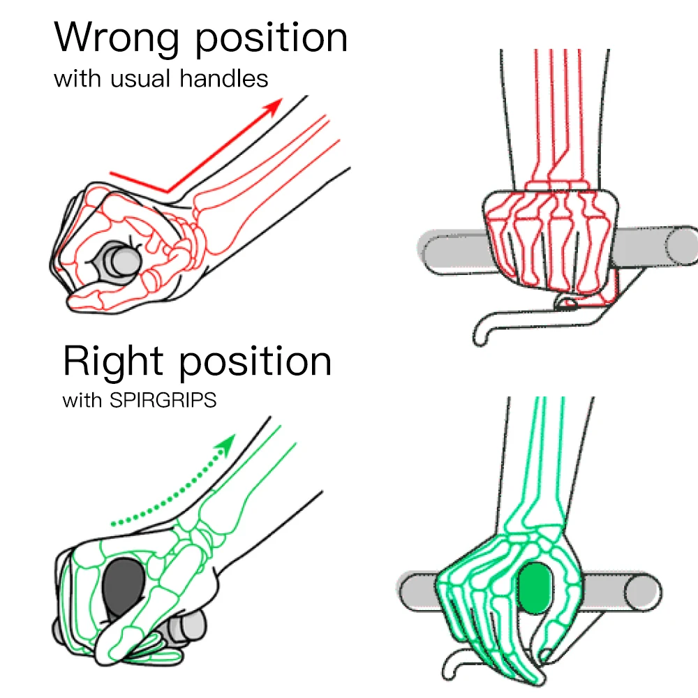 SPIRGRIPS-extremos de barra interior para bicicleta de montaña, accesorio de diseño ergonómico para bici de montaña, carretera, grava, ciudad