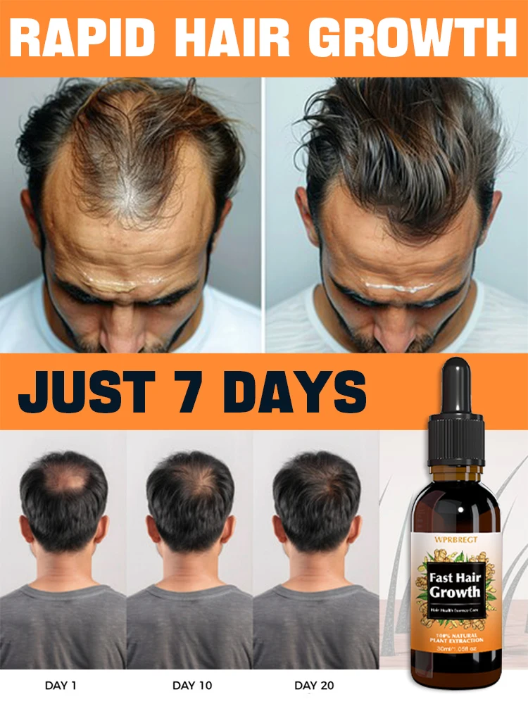 

98% of customers repurchase, have more and more hair, say goodbye to baldness