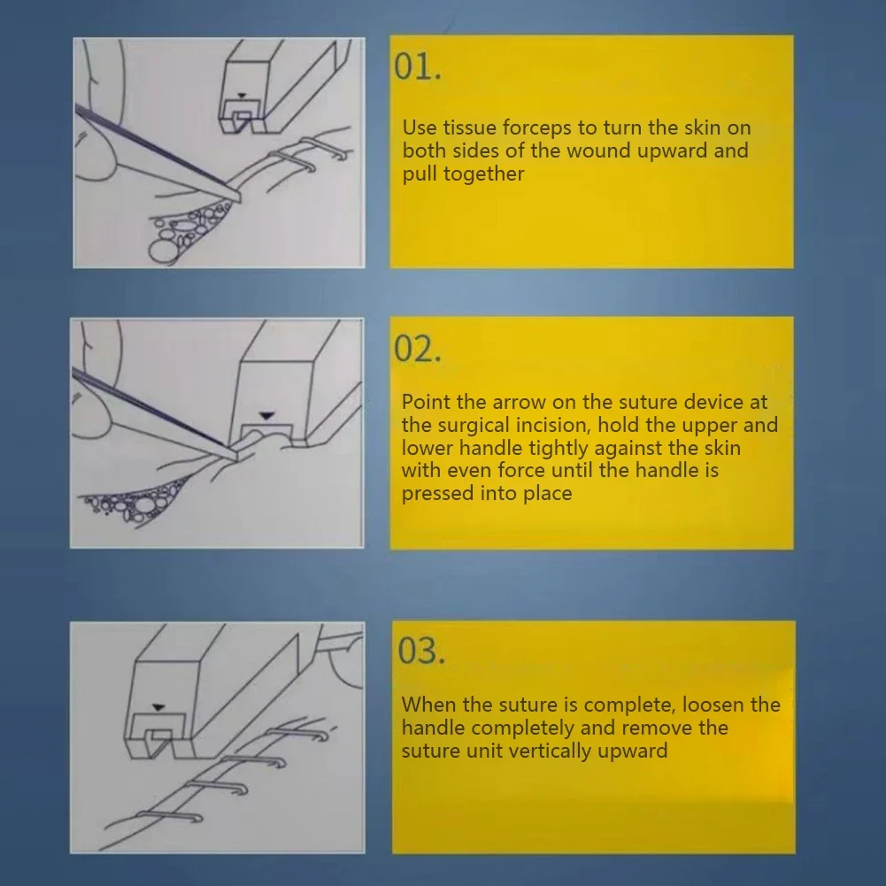 Disposable Stainless Steel Skin Stapler Surgery Stapler Nails Skin Stitching Machine Sterile Blank Package Nail Puller