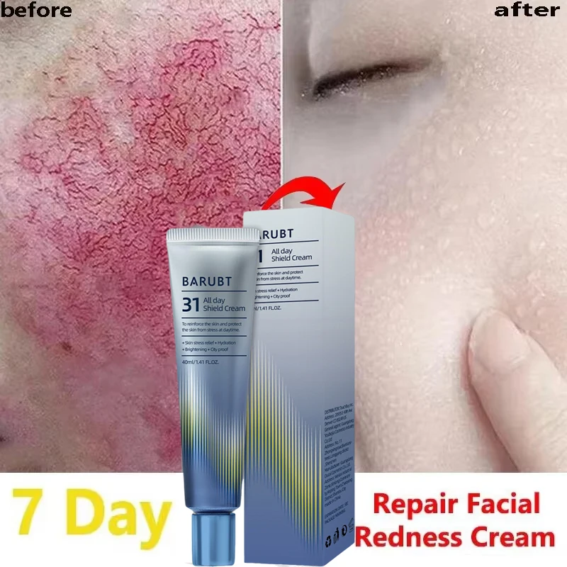 

Repair Facial Redness Cream Instant Spider Vein Remove Sensitive Skin Sooth Anti Redness Rosacea Treat Lotion Korean Cosmetics