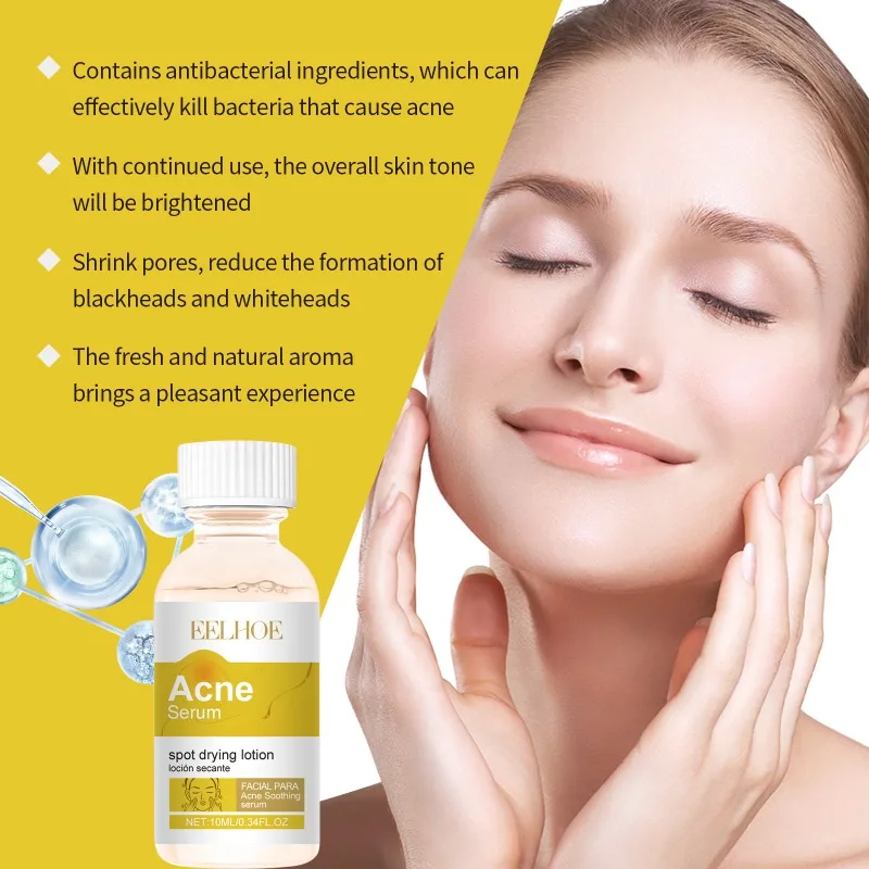 Acne Gezicht Serum Puistje Scaring Marks Zacht Verwijderen Olie Controle Gevoelige Huid Hydraterende Helderder Gezichtsserum Zachte Huidverzorging