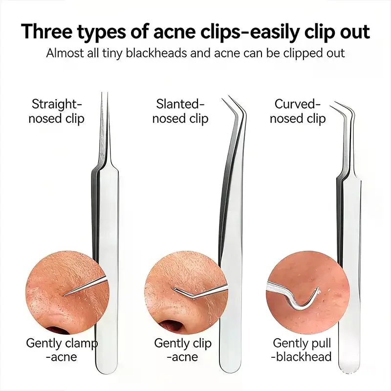 Ultra-Precise Acne And Blackhead Removal Tool Set Pro Pimple Tweezers For Effective Face Care And Skin Purification