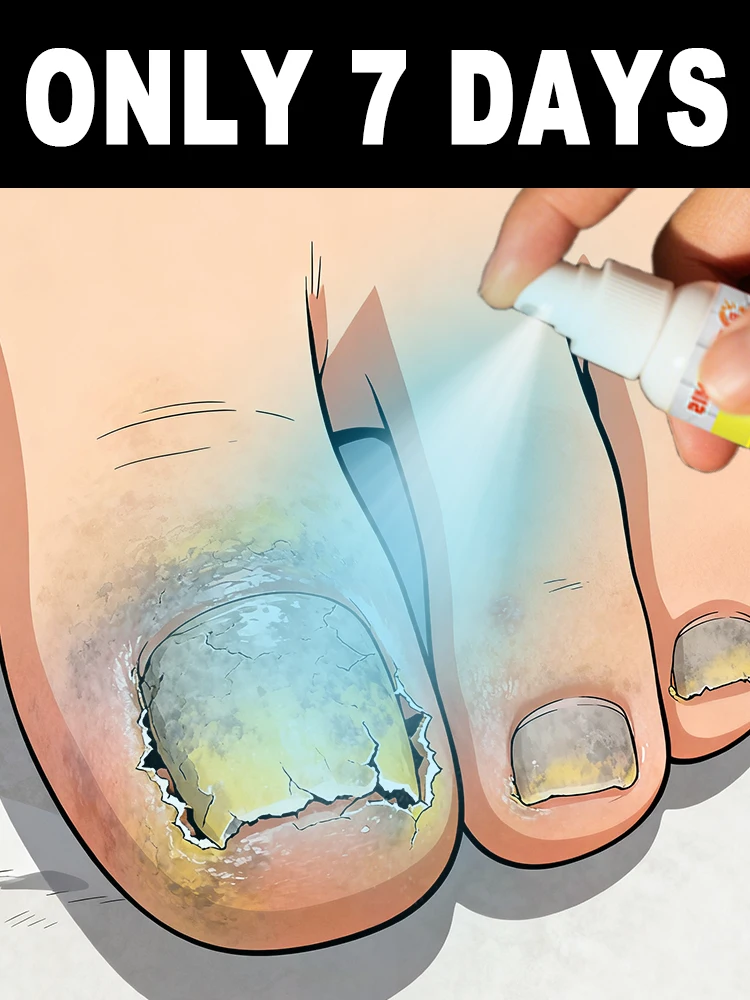 Continue using it for a few weeks, ᵃⁿᵈ ᵗʰᵉ ᵉᵐᵖᵗʸ ⁿᵃⁱˡ ʷⁱˡˡ ᵍʳᵃᵈᵘᵃˡˡʸ ᵍʳᵒʷ ⁱⁿᵗᵒ ᵃ ⁿᵉʷ ⁿ