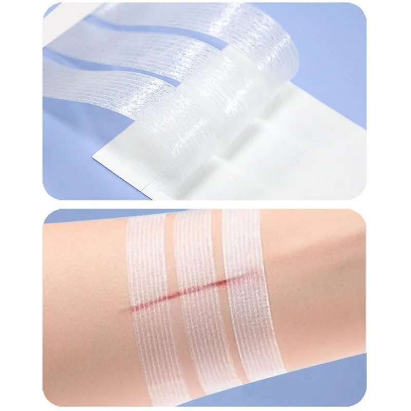 2packs Non Seam Adhesive Tape Breathable Non-woven Medical Wound Zipper Wound Closure Postoperative Care Self-adhesive Bandage