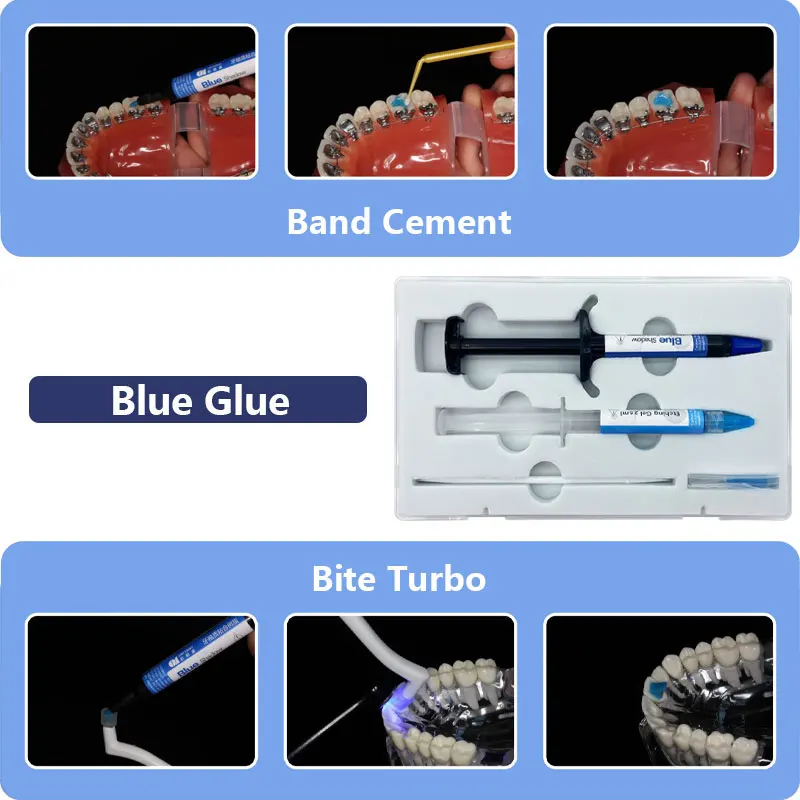 Dental Kieferorthopädische Klebstoff Selbst/Licht Heilung Kleber Kit für Orthodontia Hosenträger Klammern Blau Kleber Zahnmedizin Direkten Verkleben