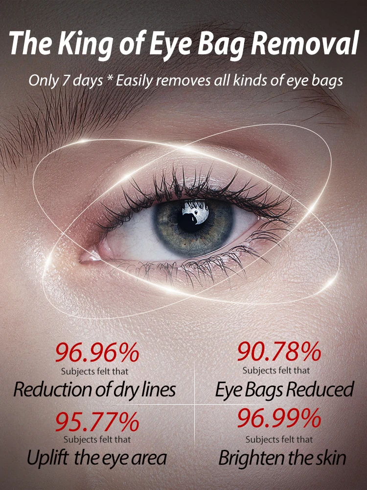 Eye Bags will Disappear nowhere cream，about 99% of people will repurchase