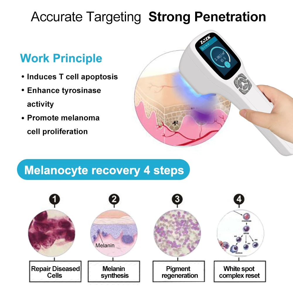 ZJZK 450mW Photodynamic Light Therapy 308nmx64diodes Skin Wand For Skin Lichen Planus Lymphoproliferative Disease Folliculitis