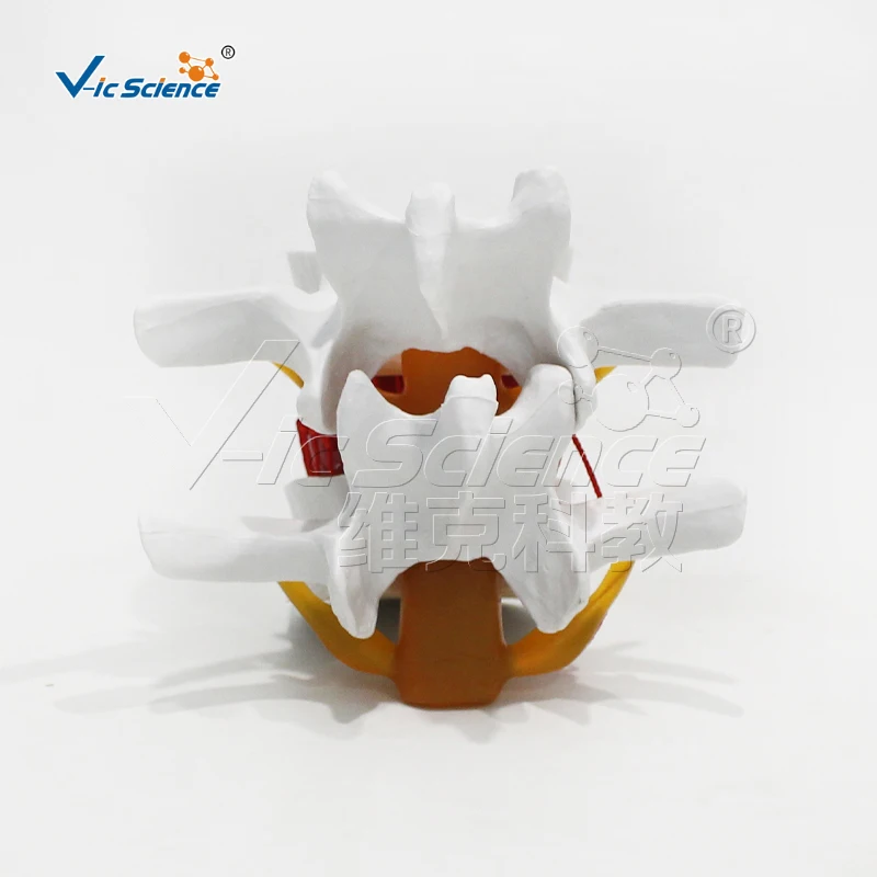 Medical Science Modelo bloqueio lombar, Espinha Humana