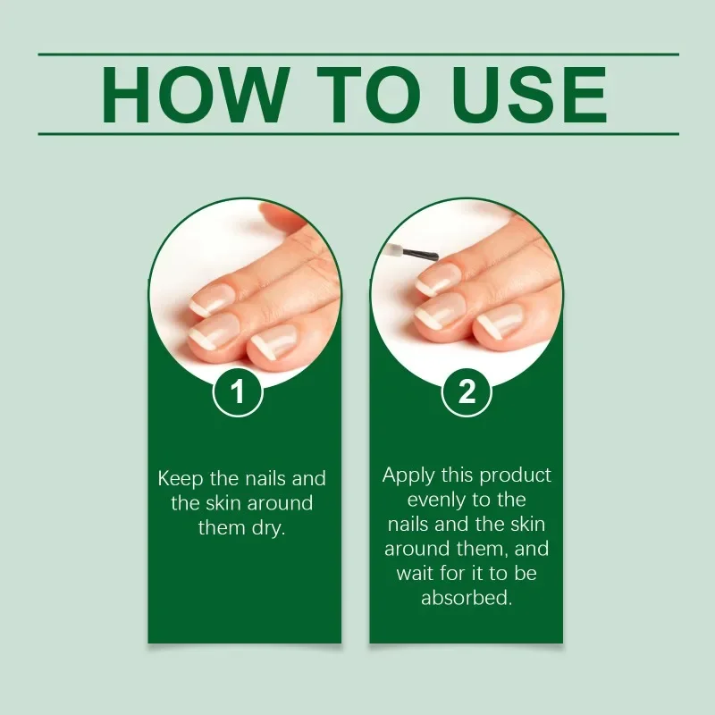 Extra starke Nagel Pilz Behandlung Serum Essenz Öl Reparatur Essenz Anti Zehen Infektion Gel Fuß Creme Entfernung Nägel Reparatur Pflege